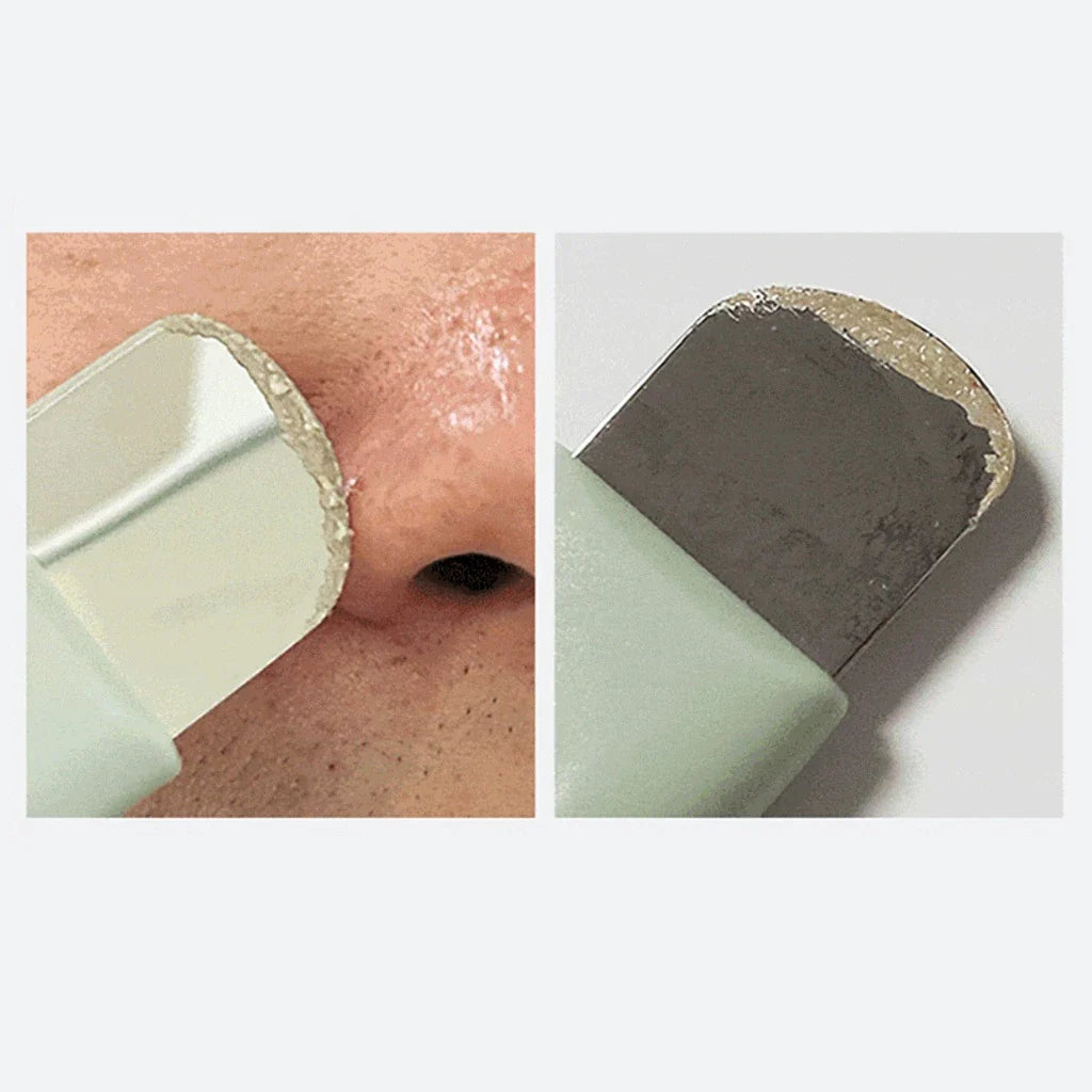 ILSO Deep Clean Master