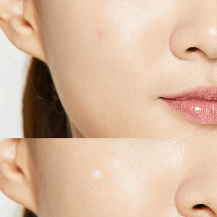 COSRX ACNE PIMPLE MASTER PATCH