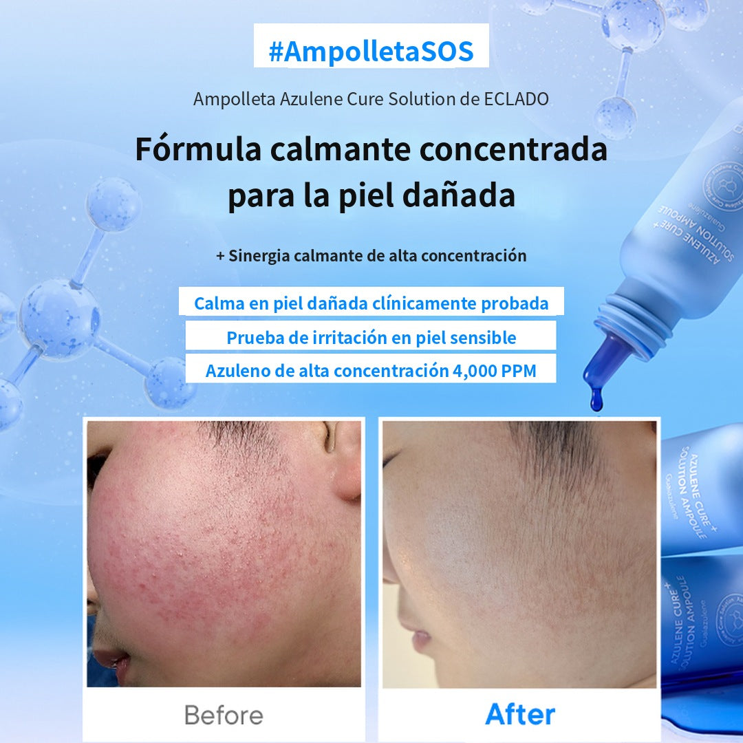 Movil 2 azulene
